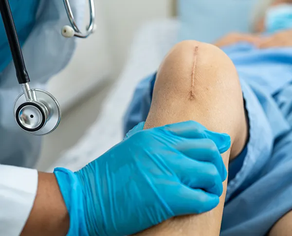 Arthroscopic surgeries For Knee and shoulder