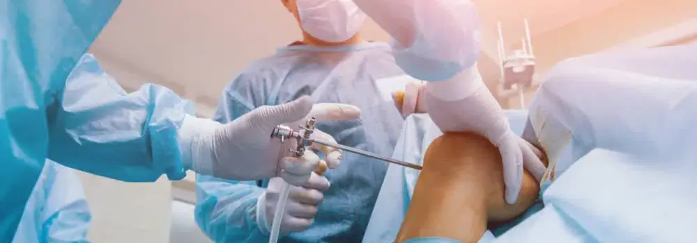 Arthroscopic surgeries For Knee and shoulder